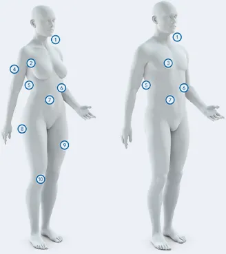 Female and Male body diagram with numbered treatment areas 