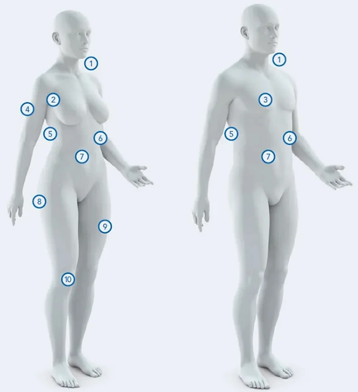 Female and Male body diagram with numbered treatment areas 